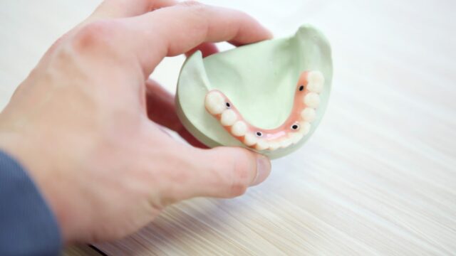 dental implants, reno cosmetic dentist