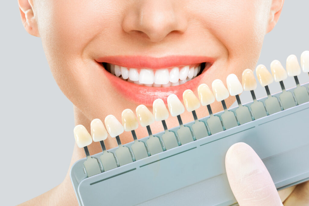 A smiling woman holding up a sample of veneers. 