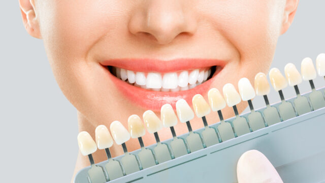 A smiling woman holding up a sample of veneers.