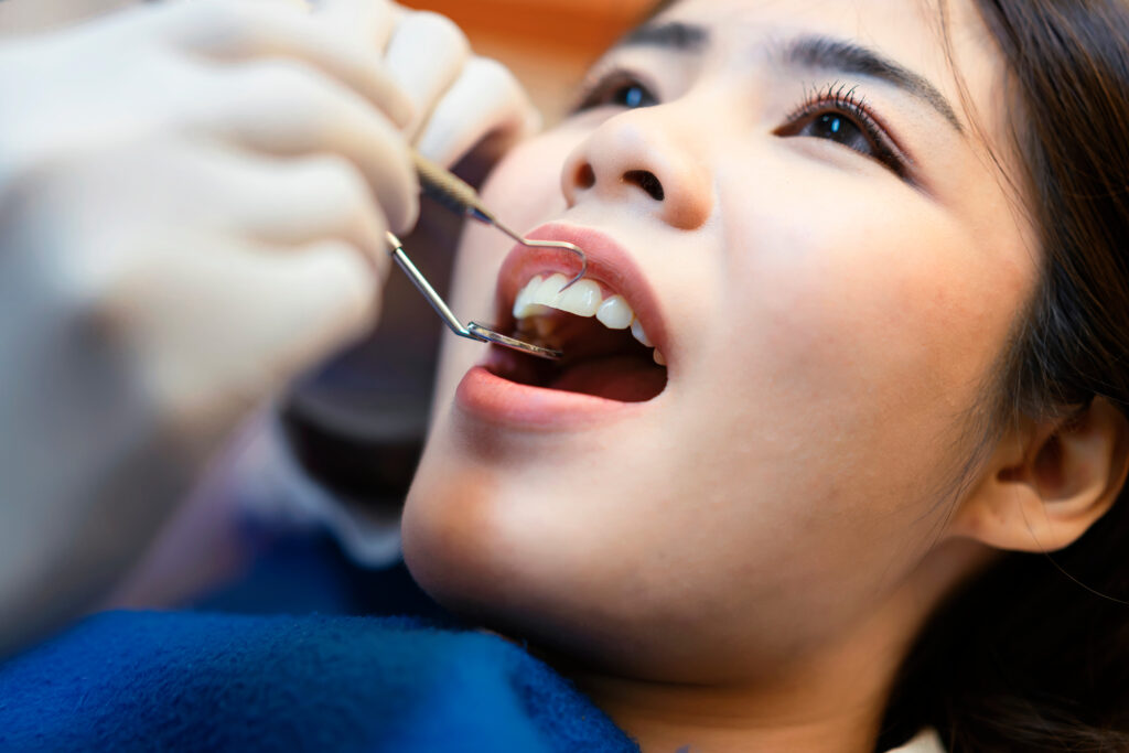 Teeth Cleaning Reno