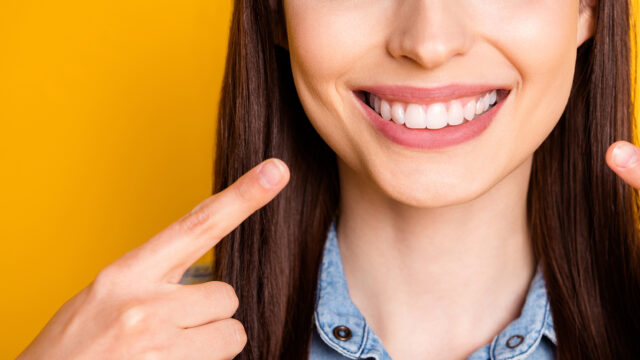 Reno Dental Associate's teeth whitening brightening and making a woman's smile more confident.