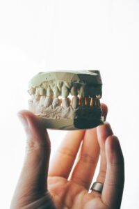 Dentist holding dental model teeth for reno teeth whitening consultation